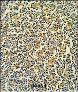 Coronin 6 Antibody in Immunohistochemistry (Paraffin) (IHC (P))
