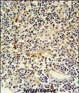 Coronin 6 Antibody in Immunohistochemistry (Paraffin) (IHC (P))