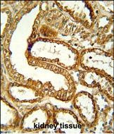 CCR1 Antibody in Immunohistochemistry (Paraffin) (IHC (P))