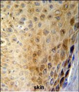 GSDMA Antibody in Immunohistochemistry (Paraffin) (IHC (P))