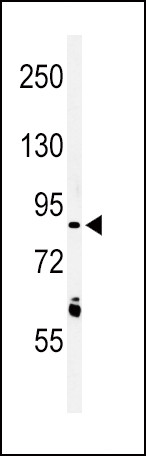 LRRN3 Antibody in Western Blot (WB)