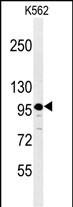 SEZ6L2 Antibody in Western Blot (WB)