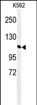 GTF2IRD2 Antibody in Western Blot (WB)