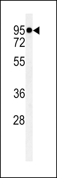 TMEM57 Antibody in Western Blot (WB)