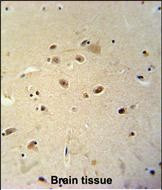 RRAGD Antibody in Immunohistochemistry (Paraffin) (IHC (P))