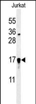 GLRX5 Antibody in Western Blot (WB)