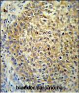 TMEM222 Antibody in Immunohistochemistry (Paraffin) (IHC (P))