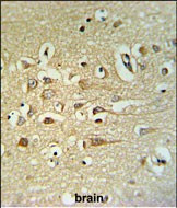 STRIP2 Antibody in Immunohistochemistry (Paraffin) (IHC (P))