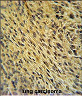 CCDC62 Antibody in Immunohistochemistry (Paraffin) (IHC (P))