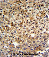KIAA1529 Antibody in Immunohistochemistry (Paraffin) (IHC (P))