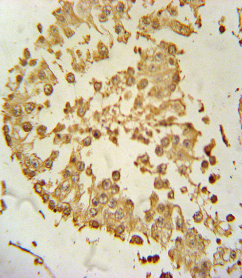 ZDHHC21 Antibody in Immunohistochemistry (Paraffin) (IHC (P))