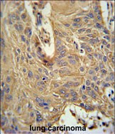 IL5RA Antibody in Immunohistochemistry (Paraffin) (IHC (P))