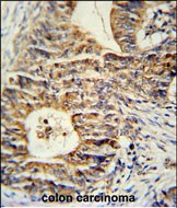 KLHL24 Antibody in Immunohistochemistry (Paraffin) (IHC (P))