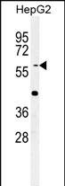 YLAT2 Antibody in Western Blot (WB)