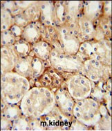 ATP5J2 Antibody in Immunohistochemistry (Paraffin) (IHC (P))