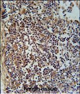 FAM49A Antibody in Immunohistochemistry (Paraffin) (IHC (P))