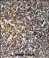 PYHIN1 Antibody in Immunohistochemistry (Paraffin) (IHC (P))