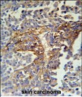 ARMC5 Antibody in Immunohistochemistry (Paraffin) (IHC (P))