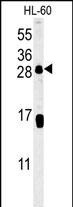 CD69 Antibody in Western Blot (WB)