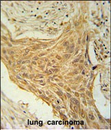 TRAG3 Antibody in Immunohistochemistry (Paraffin) (IHC (P))