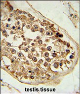 DEPDC1 Antibody in Immunohistochemistry (Paraffin) (IHC (P))