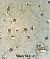 MTCH2 Antibody in Immunohistochemistry (Paraffin) (IHC (P))
