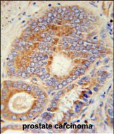 HHAT Antibody in Immunohistochemistry (Paraffin) (IHC (P))