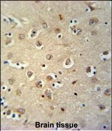 MEIS2 Antibody in Immunohistochemistry (Paraffin) (IHC (P))