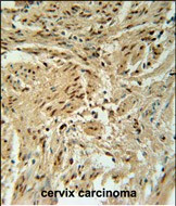 BLOC1S2 Antibody in Immunohistochemistry (Paraffin) (IHC (P))