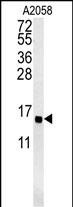 GOLT1A Antibody in Western Blot (WB)