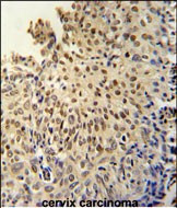 DIS3L Antibody in Immunohistochemistry (Paraffin) (IHC (P))