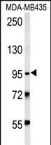 TRHDE Antibody in Western Blot (WB)