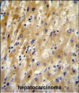 HABP2 Antibody in Immunohistochemistry (Paraffin) (IHC (P))