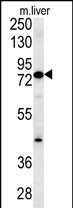 MCCC1 Antibody in Western Blot (WB)