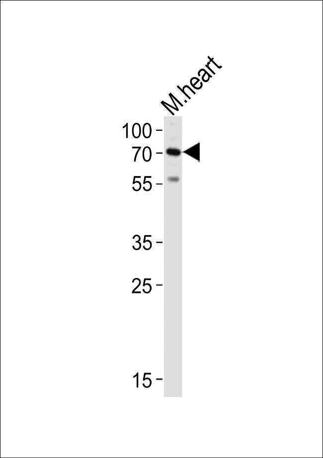HAS2 Antibody in Western Blot (WB)
