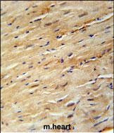 KIF24 Antibody in Immunohistochemistry (Paraffin) (IHC (P))