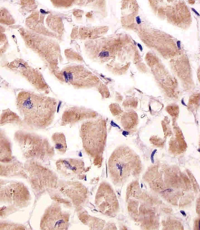 VLDLR Antibody in Immunohistochemistry (Paraffin) (IHC (P))