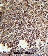KIR2DS3 Antibody in Immunohistochemistry (Paraffin) (IHC (P))
