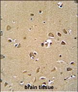 GPRASP1 Antibody in Immunohistochemistry (Paraffin) (IHC (P))