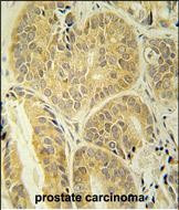 ENAM Antibody in Immunohistochemistry (Paraffin) (IHC (P))