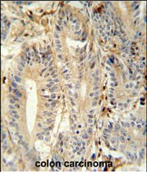 MEP1A Antibody in Immunohistochemistry (Paraffin) (IHC (P))
