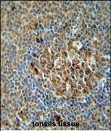 ACSF3 Antibody in Immunohistochemistry (Paraffin) (IHC (P))