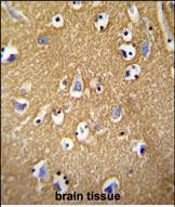 Brevican Antibody in Immunohistochemistry (Paraffin) (IHC (P))