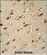 MYLK4 Antibody in Immunohistochemistry (Paraffin) (IHC (P))
