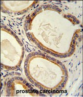 TRAM2 Antibody in Immunohistochemistry (Paraffin) (IHC (P))