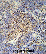 OTUD4 Antibody in Immunohistochemistry (Paraffin) (IHC (P))