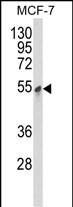 PDK3 Antibody in Western Blot (WB)