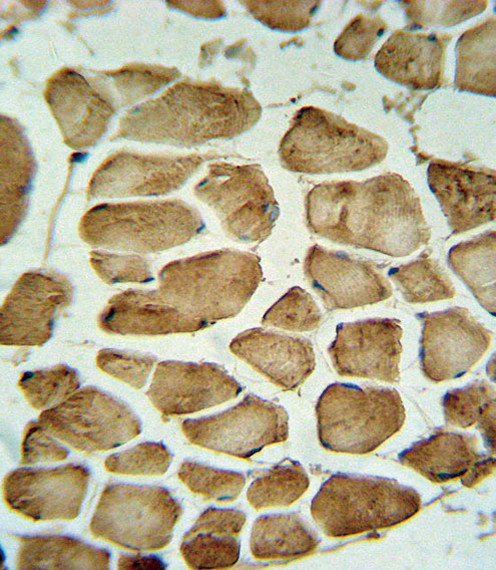 Carbonic Anhydrase III Antibody in Immunohistochemistry (Paraffin) (IHC (P))