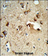 TSPAN1 Antibody in Immunohistochemistry (Paraffin) (IHC (P))