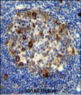 S6 Antibody in Immunohistochemistry (Paraffin) (IHC (P))